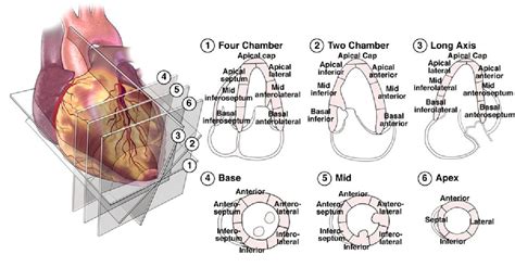 left ventricular wall motion abnormalities.